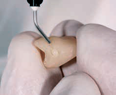 Luxatemp PLUS - коррекция формы